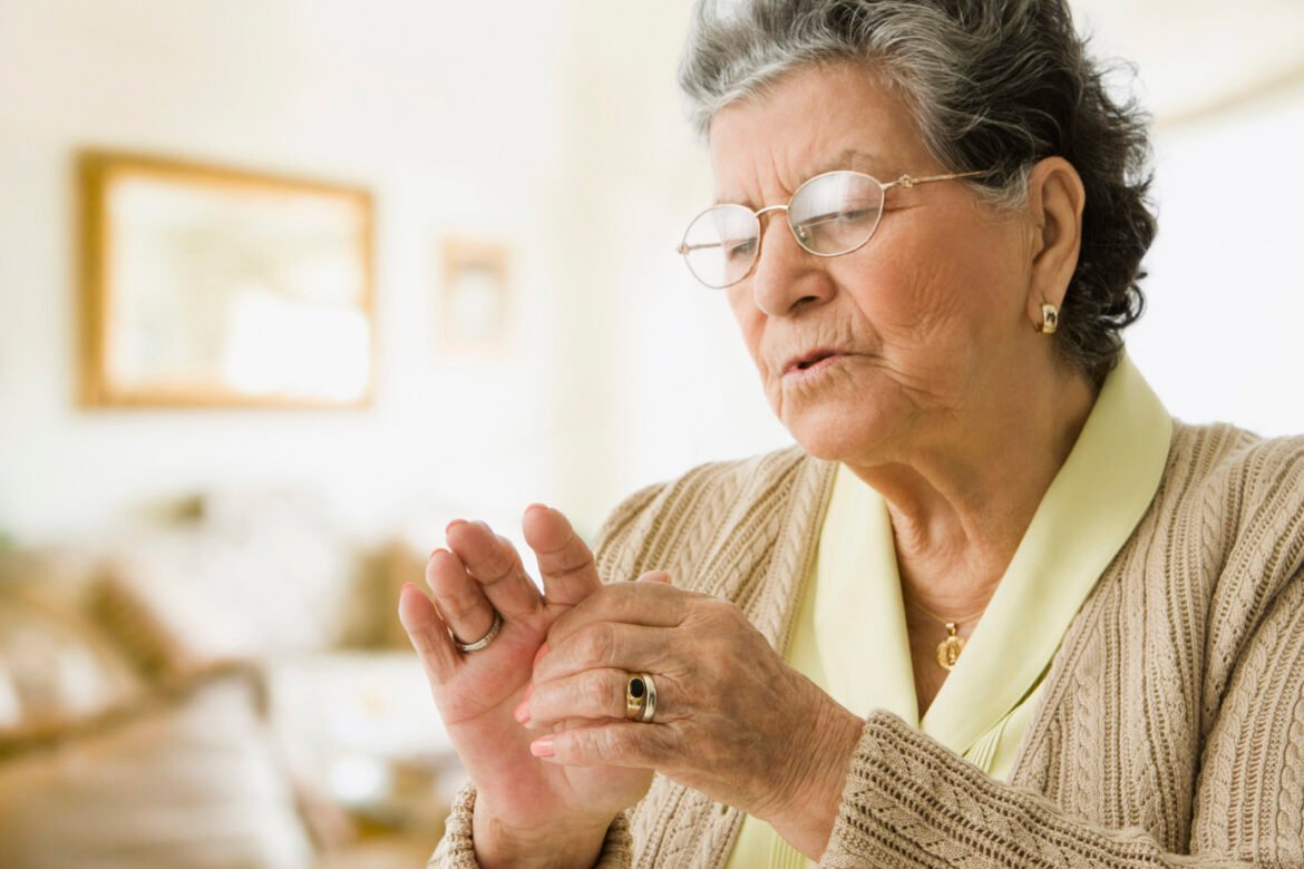 Artritis psoriásica: cuando las señales no se conectan, el diagnóstico puede llegar tarde